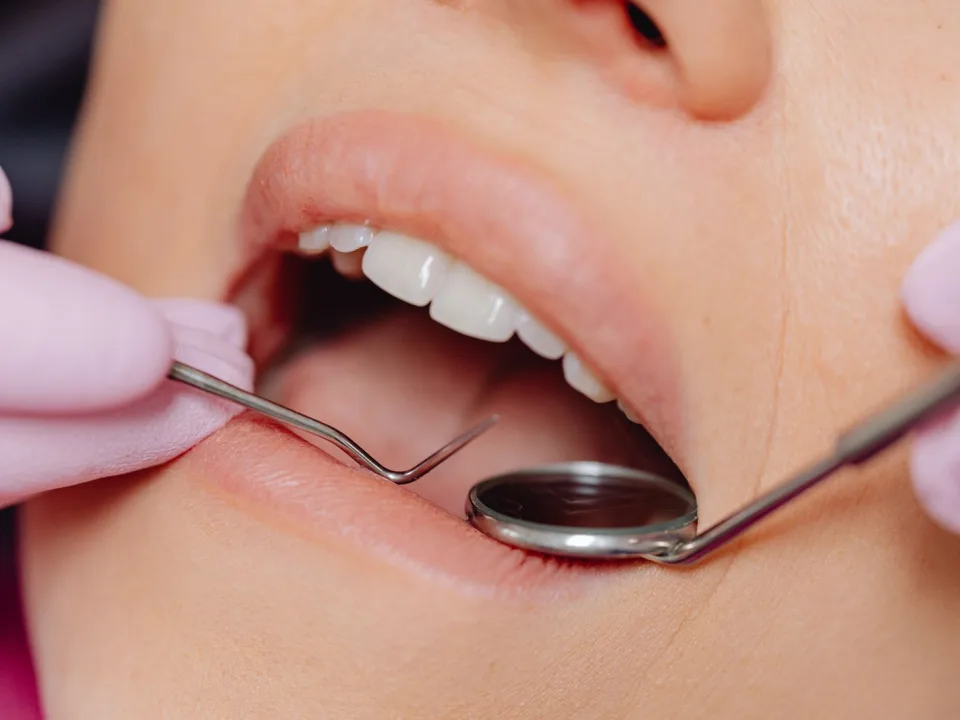 Dental examination with mirror and probe